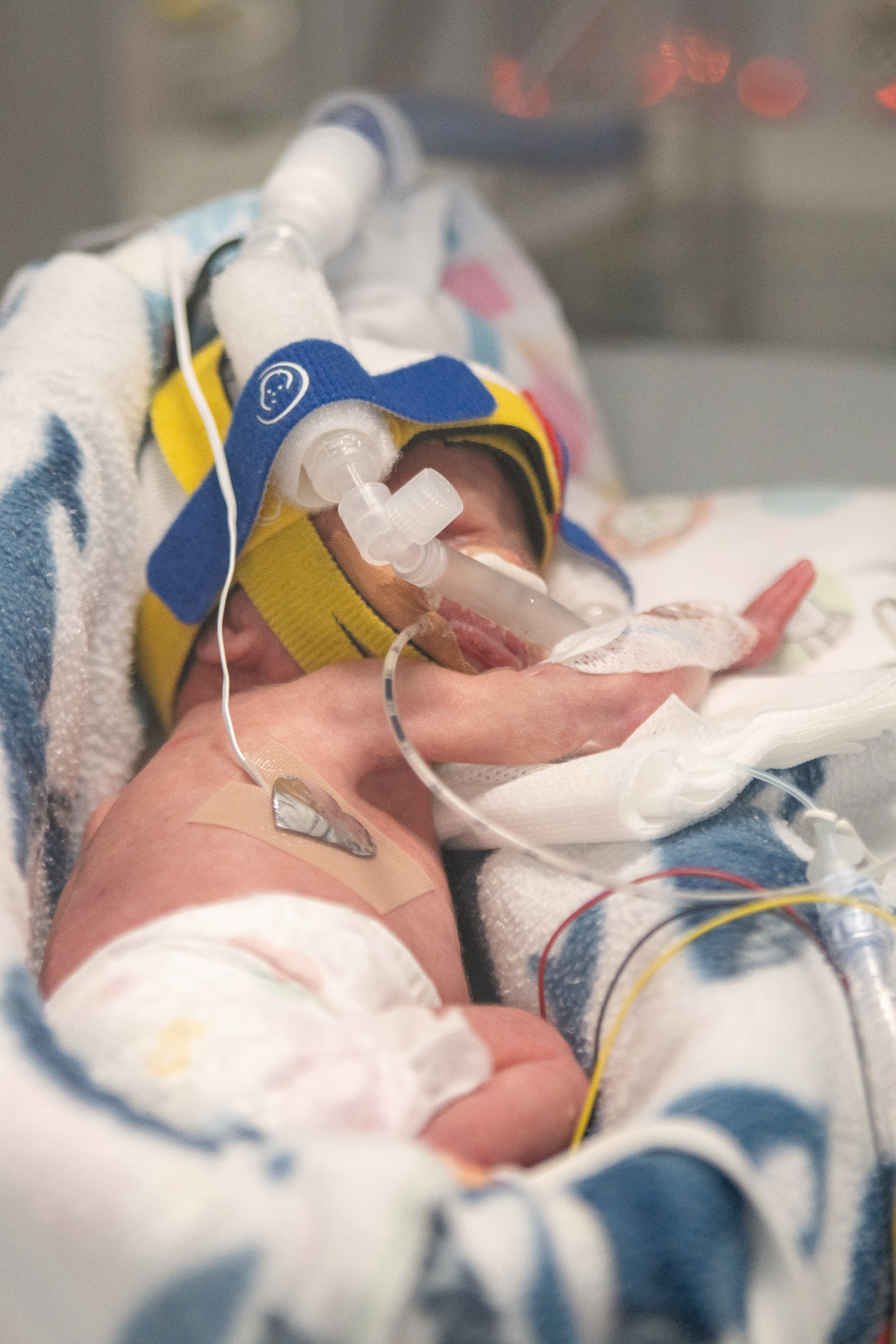 PRESS RELEASE: Federal Governments Urged to Promise Parents of Premature and Sick Babies Fair Paid Parental Leave