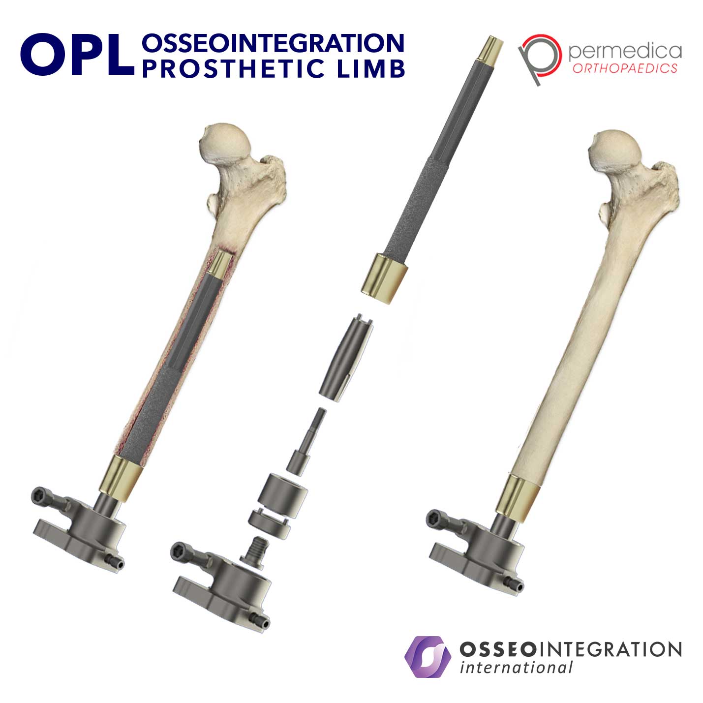 PRESS RELEASE: Osseointegration Education for Prosthetists