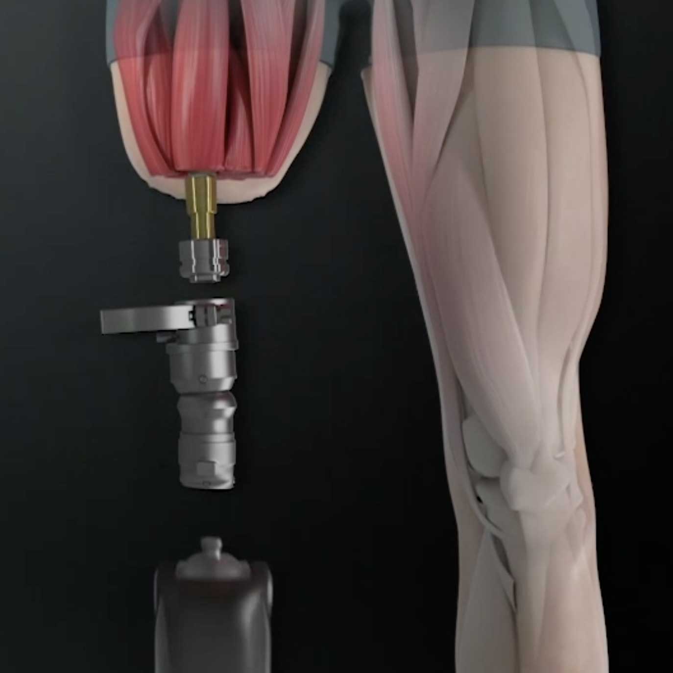 PRESS RELEASE: Professor Munjed Al Muderis Leads Investigation into Osseointegration Development